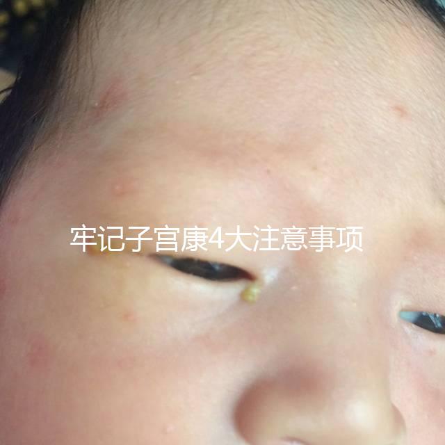 牢記子宮康4大注意事項,輕松避免胃脹、腹瀉等副作用