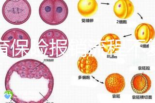 生育保險報銷流程不復雜，辦理地點不分地域異地可報銷