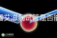 看看艾滋病試管是否能發現HCG大于150IU/ml或懷孕