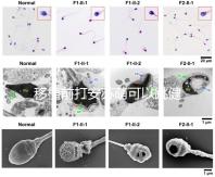 移植前打安蘇萌可以跳健身操嗎?你得到了嗎?