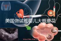 美國做試管嬰兒大概要花多少錢？具體支出25w！