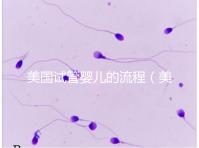 美國(guó)試管嬰兒的流程(美國(guó)試管嬰兒的流程是什么)