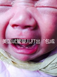 美國試管嬰兒打出“包成功”靠譜嗎?看完其中套路你就知道