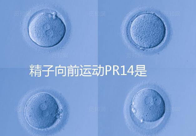 精子向前運動PR14是否正常聽專家怎么說,當(dāng)心弱精找上門
