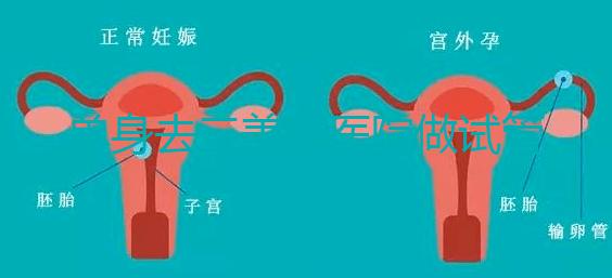 單身去三美泰醫(yī)院做試管需要花費(fèi)多少錢(qián)？費(fèi)用明細(xì)是怎么樣的