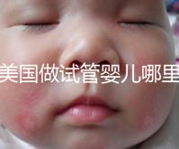 去美國(guó)做試管嬰兒哪里最好，4家好評(píng)輔助生殖機(jī)構(gòu)推薦