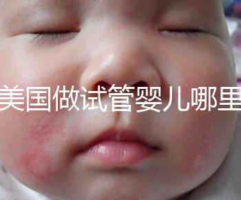 去美國做試管嬰兒哪里最好，4家好評輔助生殖機構推薦