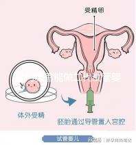 廈門(mén)哪里能做二代試管嬰兒,做一次成功率和費(fèi)用多少?