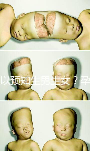 可以預知生男生女?孕婦夢見馬的胎夢解讀