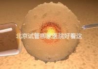 北京試管哪家醫(yī)院好看這，303醫(yī)院、北醫(yī)三院值得推薦