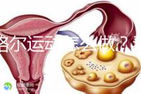 凱格爾運動怎么做？看看專業(yè)老師分享的分步驟圖解