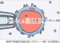 別糾結(jié)4ca囊胚解凍復(fù)蘇最早幾天能測出了,著床率先了解下