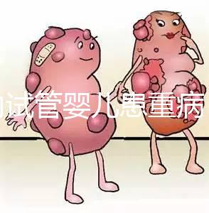 國內試管嬰兒患重病 試管是否存在健康隱患？