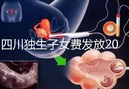 四川獨(dú)生子女費(fèi)發(fā)放2024年新規(guī)定，如何盡快領(lǐng)取自貢？