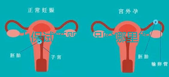 人保試管嬰兒保險(xiǎn)哪里能買(mǎi)、怎么買(mǎi)速覽,一篇看懂不踩坑