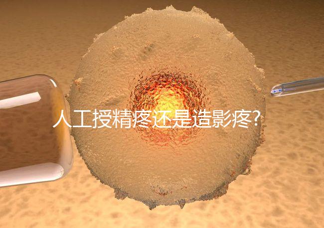 人工授精疼還是造影疼?被瞎對比，二者疼痛不是一個等級