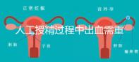 人工授精過程中出血需重視！這3種情況會影響成功率