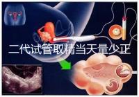 二代試管取精當天量少正不正常60s弄清,不造怎么辦速覽