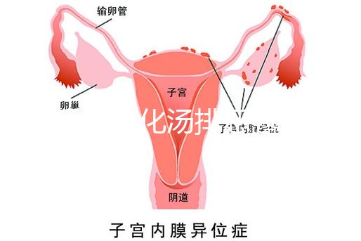 產后喝生化湯排惡露會使寶寶拉肚子?醫生:時間沒用對