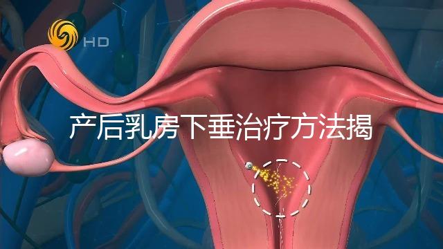 產后乳房下垂治療方法揭秘，按摩手法再好也沒提前預防有用