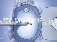 從預(yù)約到操作過程，這份tct檢查流程攻略請查收