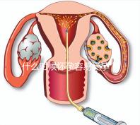 什么時候懷孕容易受孕?