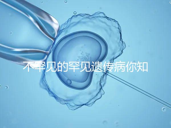 不罕見的罕見遺傳病你知道嗎?帶你認(rèn)識下特納綜合癥