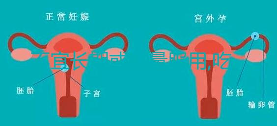 不宜長(zhǎng)期或過量服用,吃DHEA要注意這3點(diǎn)