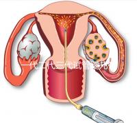 一代二代三代試管嬰兒有什么區(qū)別?