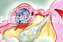 丁桂兒臍貼適用年齡沒明確規(guī)定，但初次使用必須滿月