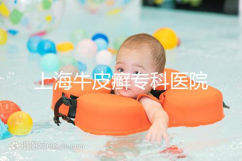 上海牛皮癬專科醫(yī)院