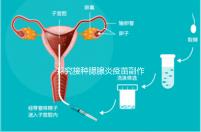 探究接種腮腺炎疫苗副作用,出現(xiàn)發(fā)燒用這3招應對自如