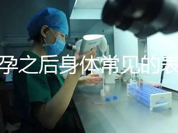 懷孕之后身體常見(jiàn)的表現(xiàn)是什么