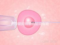 懷孕期間做哪些運動有助于自然分娩?