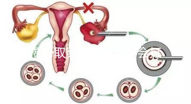 揭秘取卵后醫生會不會打電話問選幾代？這些問題會涉及到