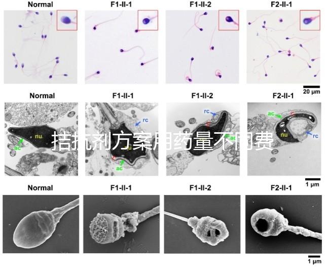 拮抗劑方案用藥量不同費用也不一樣，看看大家都花了多少
