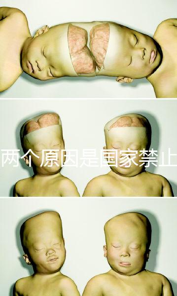 有兩個(gè)原因是國家禁止中非混血中國會(huì)接受嗎?