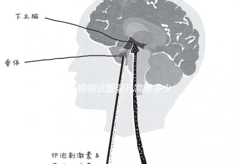 未婚做試管嬰兒需要多少錢?公立醫院費用大概在3-12萬