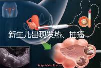 新生兒出現發熱、抽搐，很可能是胎毒的表現