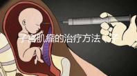 子宮肌瘤的治療方法(子宮肌瘤自己排出圖片)