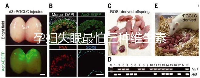 孕婦失眠最怕三種維生素快收藏！B1和B12哪個(gè)好一看便知