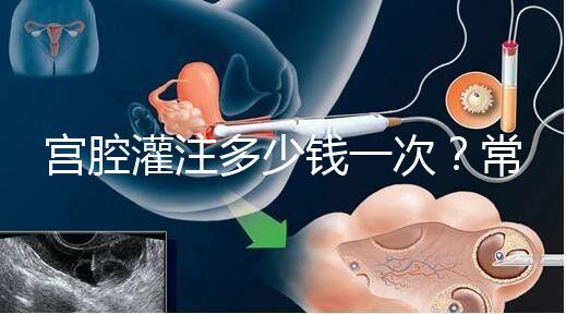 宮腔灌注多少錢一次？常見疑問匯總答疑