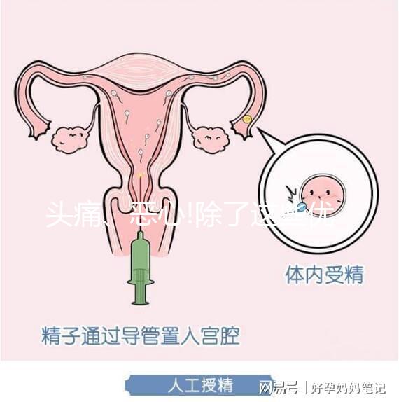 頭痛、惡心!除了這些優思明副作用還有哪些