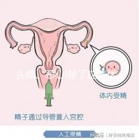 頭痛、惡心!除了這些優思明副作用還有哪些