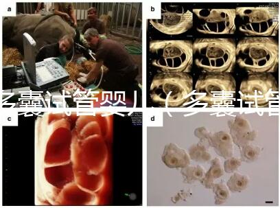 多囊試管嬰兒（多囊試管嬰兒成功率高嗎）