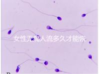 女性無痛人流多久才能恢復健康?