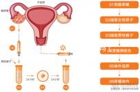 女扎后能做試管嬰兒嗎（45歲結扎了還能做試管嬰兒嗎）