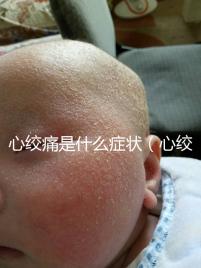 心絞痛是什么癥狀(心絞痛有什么癥狀和感覺(jué))