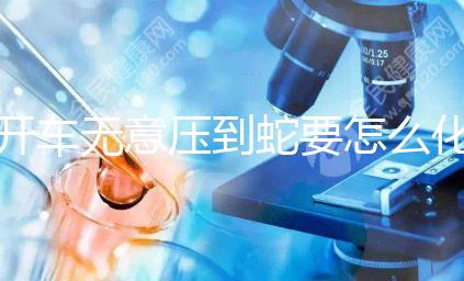 開(kāi)車(chē)無(wú)意壓到蛇要怎么化解進(jìn)來(lái)瞧,要不要報(bào)警一目了然