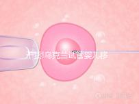 干貨!烏克蘭試管嬰兒移植后注意這些事項(xiàng),輕松提高30%成功率